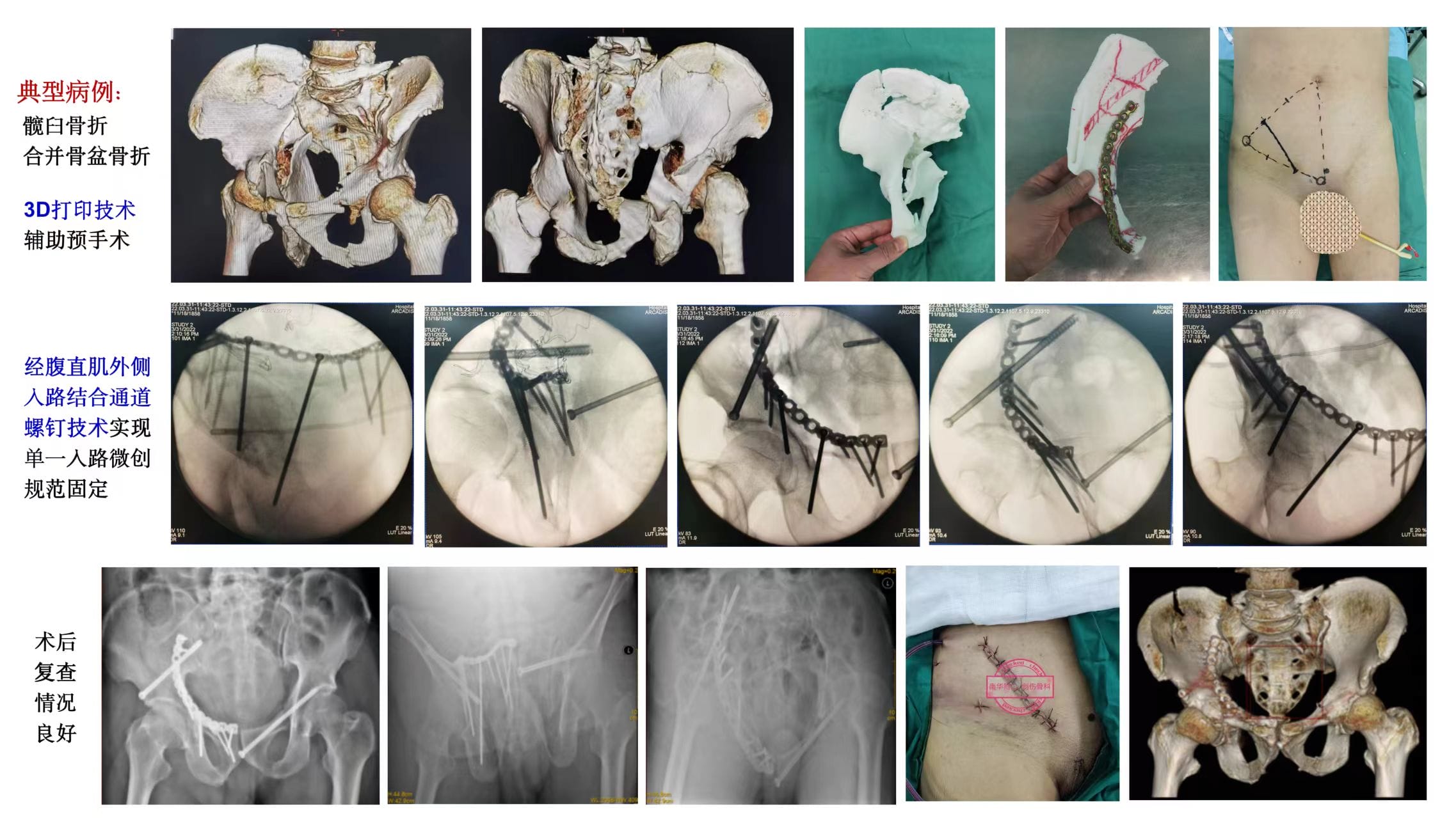 56ae17b6c24f4617caeb32e0075f9f88_.jpg 56ae17b6c24f4617caeb32e0075f9f88_.jpg