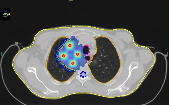 图片17.png 图片17.png